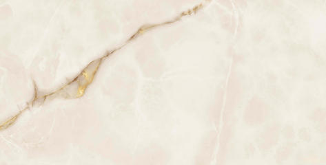 Symphonyx Gold Rett 60x120 Lapp
